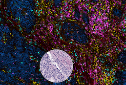 thumbnail for publication: High-plex immunofluorescence imaging and traditional histology of the same tissue section for discovering image-based biomarkers
